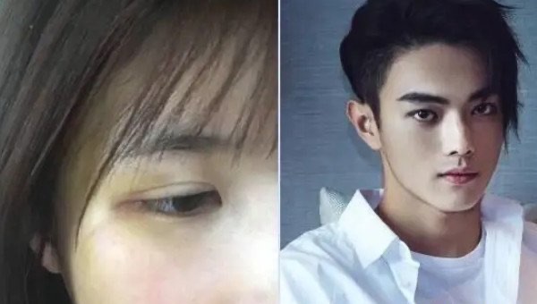 网络配图 网络配图